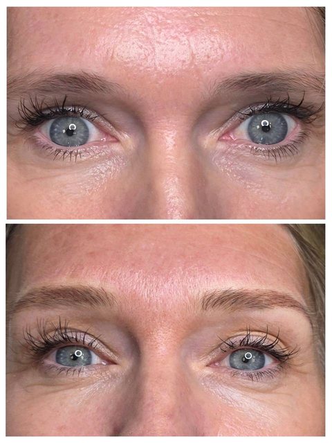 A client's brows at the start of her appointment and after healing, eyes open.